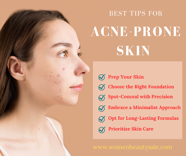 Best Practices for Acne Prone Skin