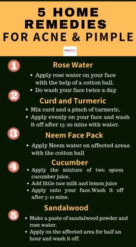 Best Tips for Acne Free Skin