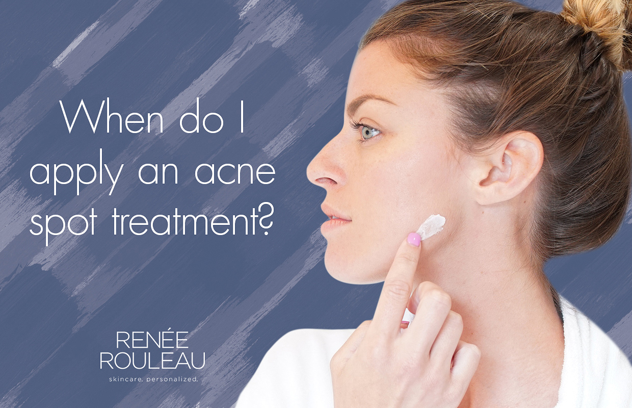 When is the Best Time to Apply Acne Cream